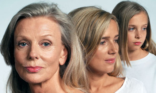 Changes related to the aging of the skin of the face