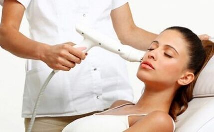 Laser used for the rejuvenation of fractional laser laser