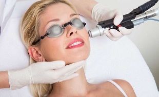 how the procedure for facial skin rejuvenation with laser is performed