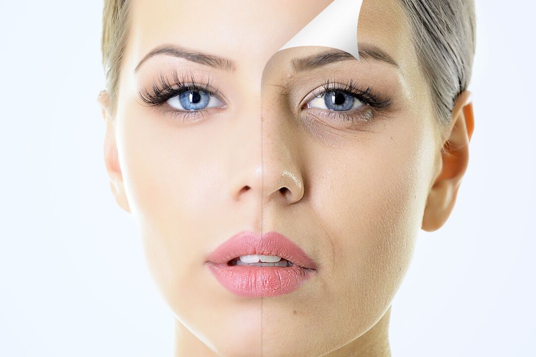 Skin rejuvenation