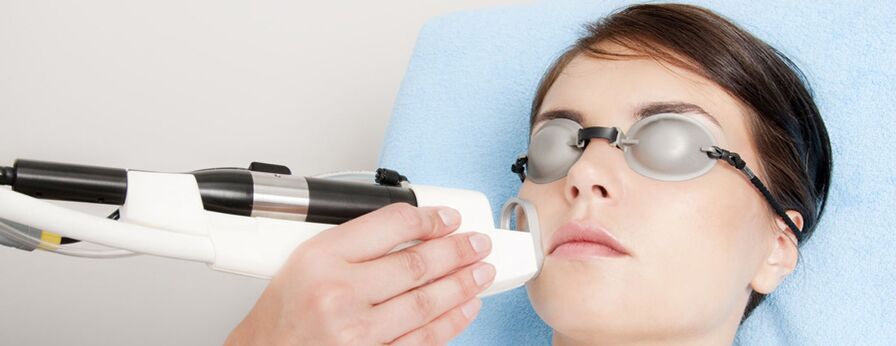Rejuvenation of the field laser skin laser
