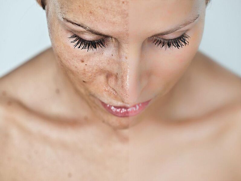 Face the procedures before and after