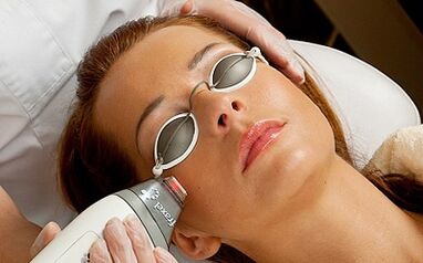 the essence of the fractional laser skin rejuvenation procedure